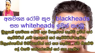 මුහුණේ අනවශ්‍ය රෝම Blackheads Whiteheads Remove කරමු | Peel off face mask sinhala with dileebeauty