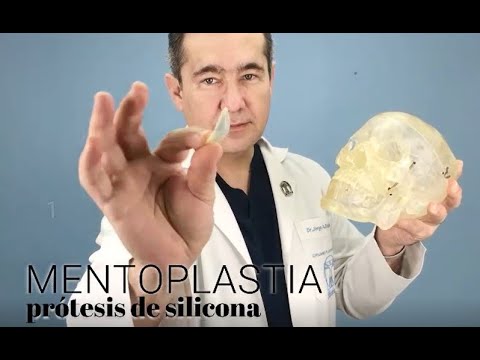 Video: Las Estrellas Que Hicieron La Cirugía Plástica Del Mentón: ¿quién Se Convirtió En Una Belleza Y Quién Fue Un Coco?