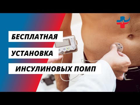 Бесплатная установка инсулиновых помп