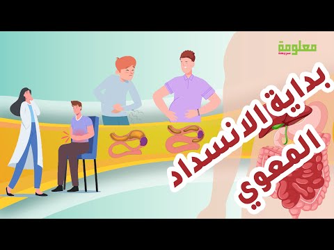 كيف تظهر أعراض الانسداد المعوي