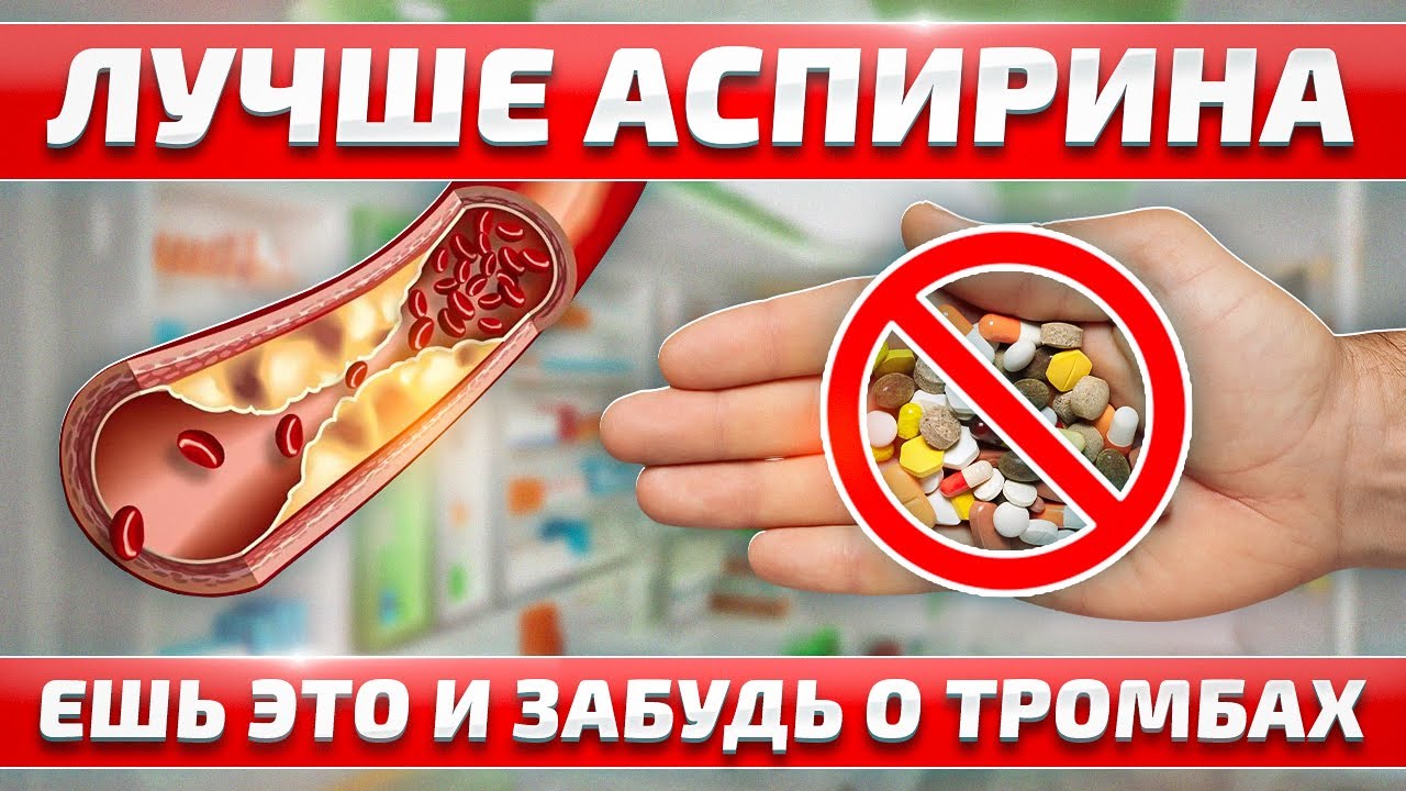 Моторная бляшка это