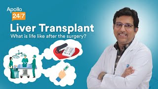 What Is Life Like After a Liver Transplant? | Dr Madhusudhanan J | Apollo 24|7 What Is Life Like After a Liver Transplant? | Dr Madhusudhanan J | Apollo 24|7