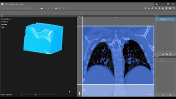 DICOM to Print Lung Segmentation!