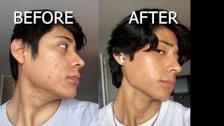 HOW TO GET A SHARP JAWLINE - Top 3 methods no one is talking about!