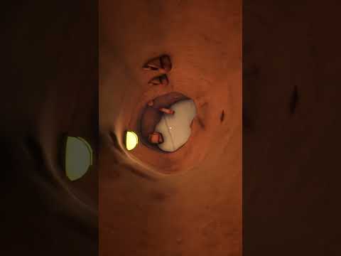What Happens if you Dig Corner First? #gaming #youtubeshorts