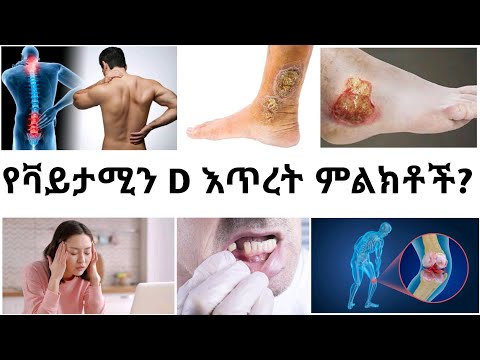 ቪዲዮ: Cast ን ለማፅዳት 3 መንገዶች