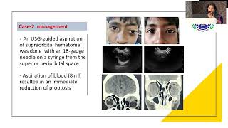 Aiocmtc4 2025 - Free Paper - Trauma