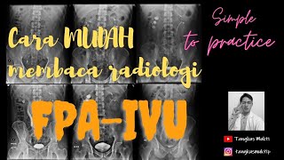 Interpretasi Radiologi FPA-IVU (Foto Polos Abdomen-Intravena Urografi) pd Hidronefrosis&Hidroureter