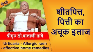 Allergic Rash-Urticaria - Effective Home Remedies शतपतत पतत क अचक इलज