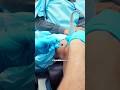 Lubricating Bone-on-Bone Knee Joint Friction 💧#KneeGel #KneeArthritis #Doctor #nyc