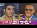 El antes y despus de los famosos - Jarabe de Pico