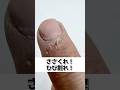 ささくれ！ひび割れ！#ささくれ#ひび割れ#肩こり#首こり #頭痛#整体 #新川崎 #夢見整体院