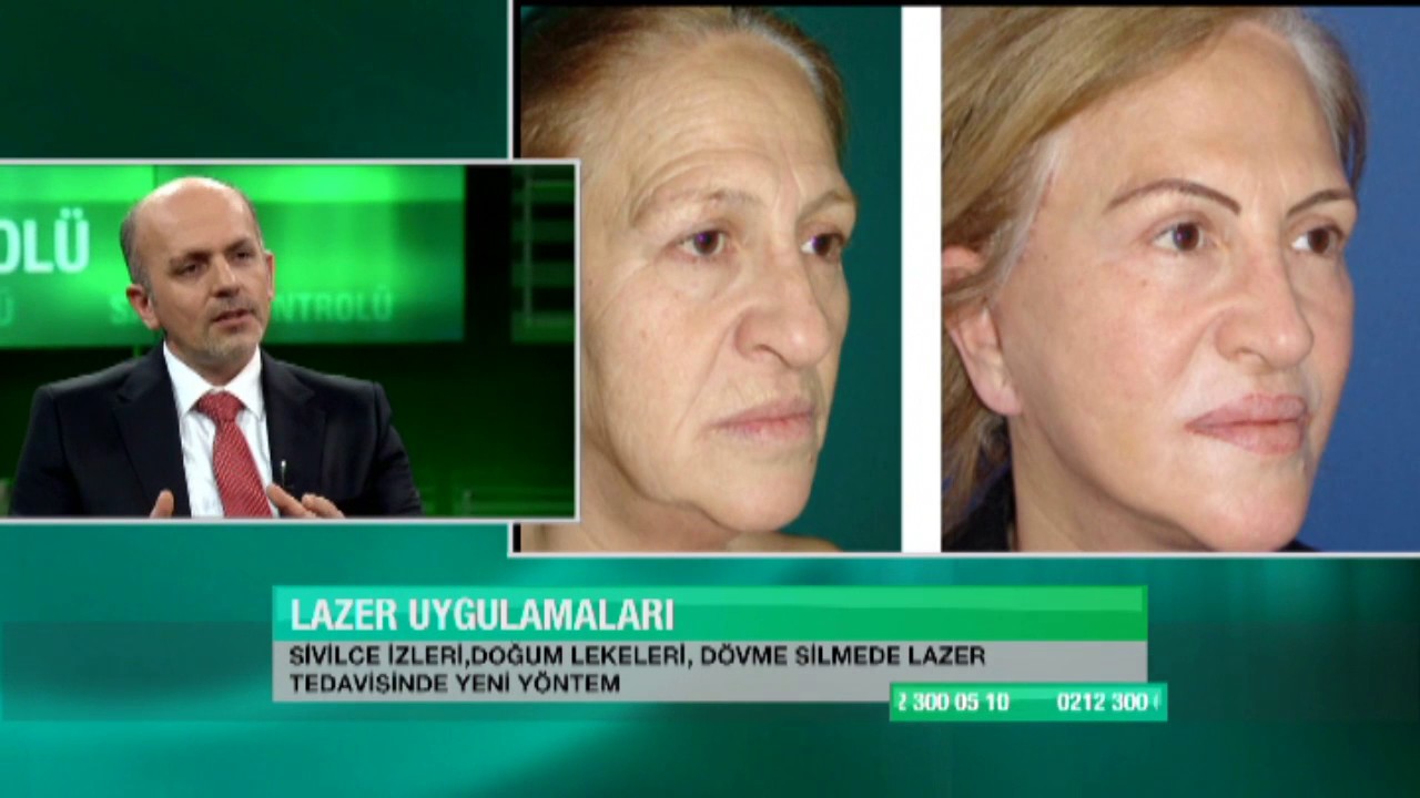 Cilt ve Doğum Lekelerine Karşı Kür Cilt ve Doğum Lekelerine Karşı Kür