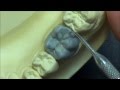 Live wax up  lower 1st molar wax up full