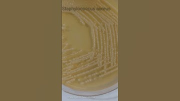 Staphylococcus aureus in Nutrient Agar