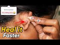 How to heal ear piercing fast qna ravina gupta