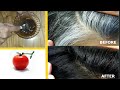 🍅 Your HAIR From WHITE to BLACK NATURALLY In Just 4 MINUTES || PERMANENT Dimming.