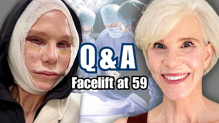 Facelift Over 50 Q&A | The Truth About Recovery, Cost & Results