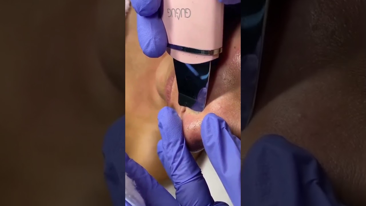 GUGUG Skin Spatula for Facial Deep Cleansing (Pink)