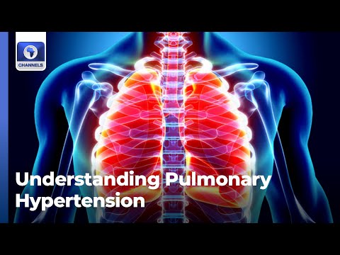 Pulmonary Hypertension: What