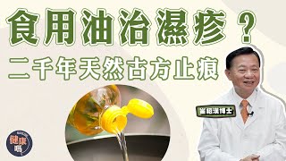 轉季濕疹患者必看！ | 改善#濕疹 就靠一種食用油？｜中醫5大濕疹止痕法 重症濕疹患者當寶｜二千年前天然古方 嬰兒都用！｜健康嗎@HealthCodeHK【問問崔博士】濕疹篇上集#eczema