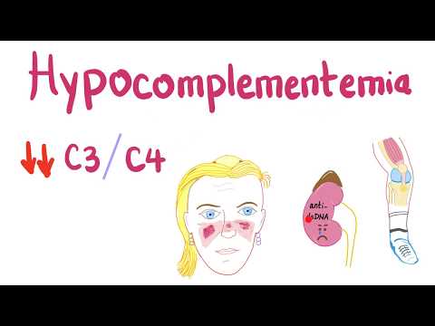 Hypocomplementemia (निम्न प्लाज्मा पूरक स्तर)