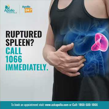 How do you know if your Spleen is ruptured?|How long does it take to bleed out from Ruptured Spleen?