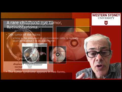 3.3 Retinoblastoma - a rare childhood eye tumor