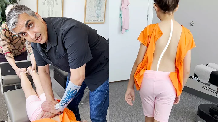 Scoliosis Treatment with Gonstead Chiropractic Care |Ep1| Dr. Rahim