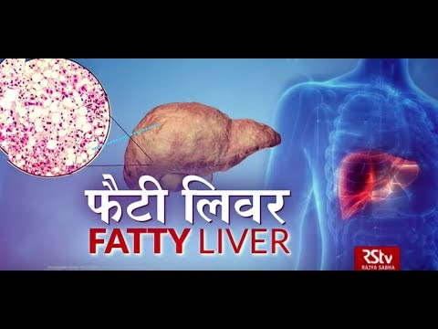 Ayushman Bhava: फैटी लिवर | Fatty liver