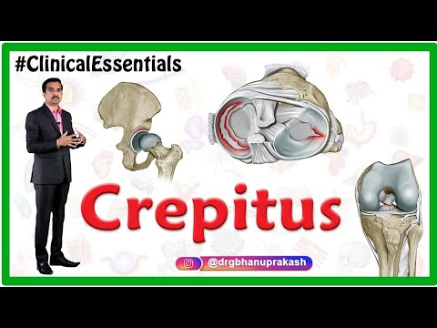 Crepitus of the Joints - Clinical essentials