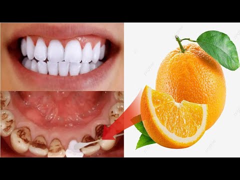 Teeth whitening in seconds removes yellowing and tartar falls after rubbing your teeth with it