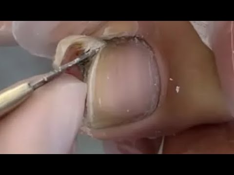 Pedicure tutorial: Pretty long nail treatment 1 hqdefault