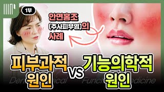 주사피부염 기능의학적 치료사례/ 원인과 감별진단해야할 질환들