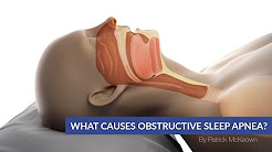 What Causes Obstructive Sleep Apnea