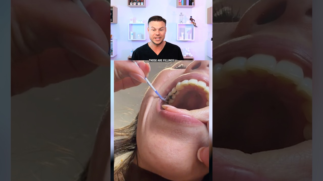 I Bet You Didn’t Know THIS About Cavities! 😳🦷