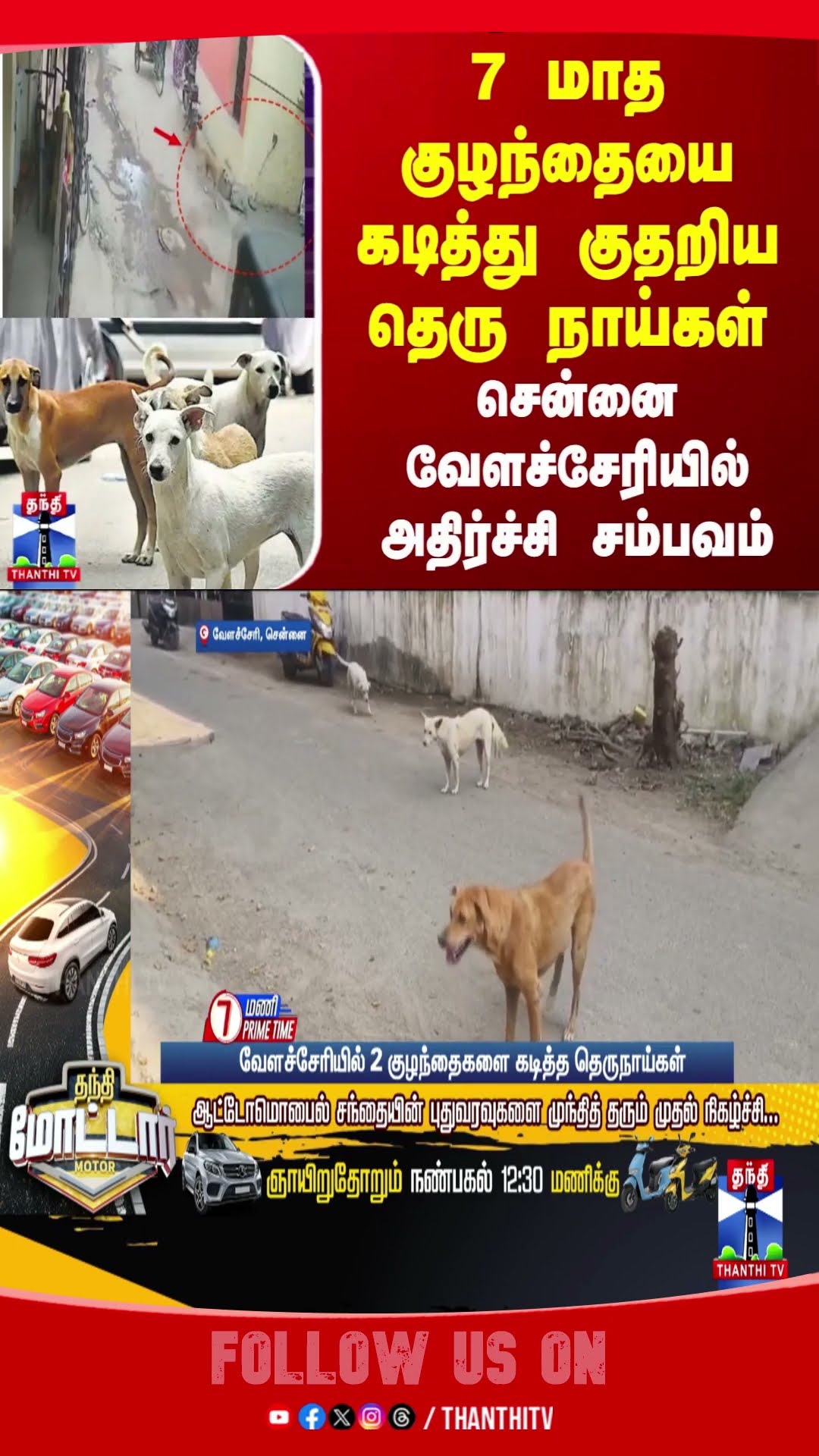 chennai || velacherry || baby || dog attack || bite ||