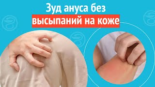 😟 Зуд Ануса Без Высыпаний На Коже. Клинический Случай №1282