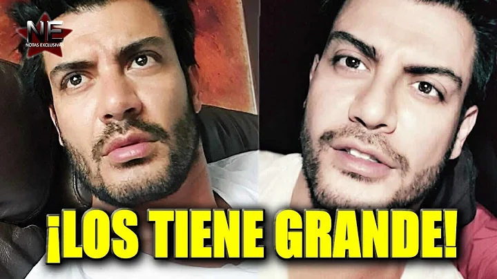Andres Palacios confiesa su defecto fsico que ha a...