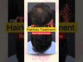 Real Patient Review: Does Hair Regrowth Treatment Actually Work? | HairMD Clinic, Pune