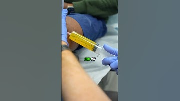 How to alleviate knee pain? #kneepain #painmanagment #painrelief