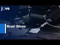 Image-guided Patch Clamp to Study Neurons in Brain Slices | Protocol Preview