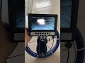 7mm camera lens pipe inspection camera