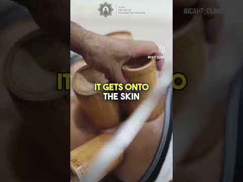 HOW TO... Fire