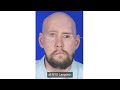 One Year Later: First Whole-Eye and Partial-Face Transplant Patient Makes Remarkable Progress
