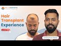 Hair Transplant Journey at AlloRoots - Mr. Anshuman Barik's Transformation| @alloroots