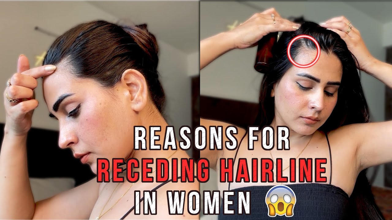 Female hairline vs male hairline: 4 main differences - 2pass Clinic