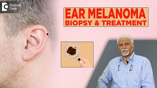Skin Cancer in Ear| Melanoma inside Ear Diagnosis & Treatment - Dr. Harihara Murthy |Doctors' Circle