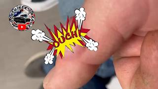IF HE DON'T GO TO THE DOCTOR...THAT'S GOING TO EXPLODE!!!