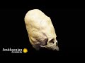 Cranial Modification Practices and Perceptions